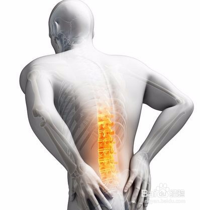 如何缓解椎间盘突出?