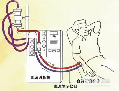 现在治疗急性肾小球肾炎的方法有哪些