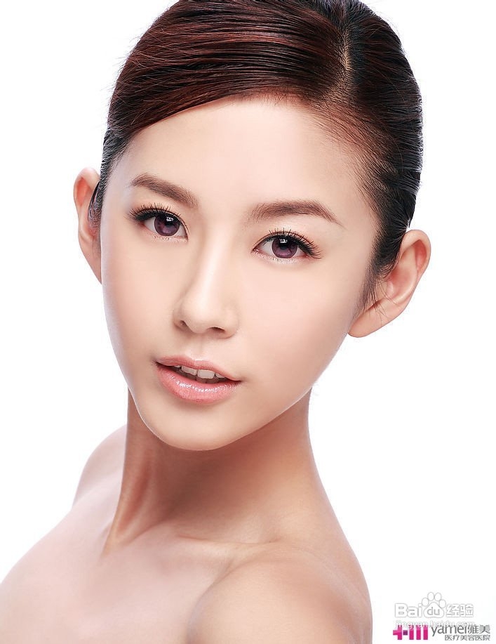 原发性闭角型青光眼