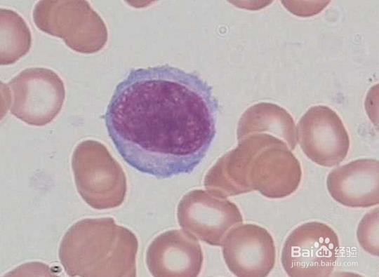 怎样辨认骨髓片子？这是哪种细胞啊？