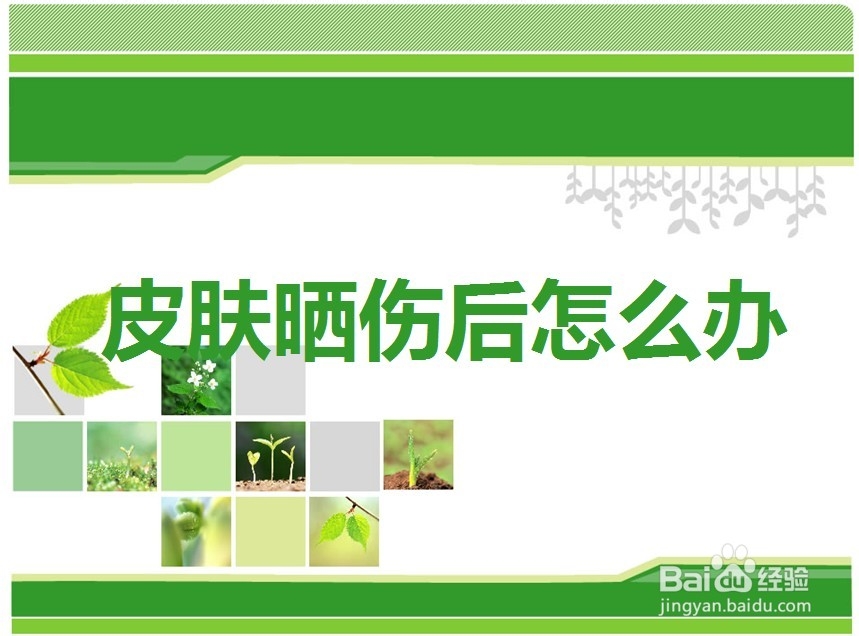 皮肤晒伤后怎么办?
