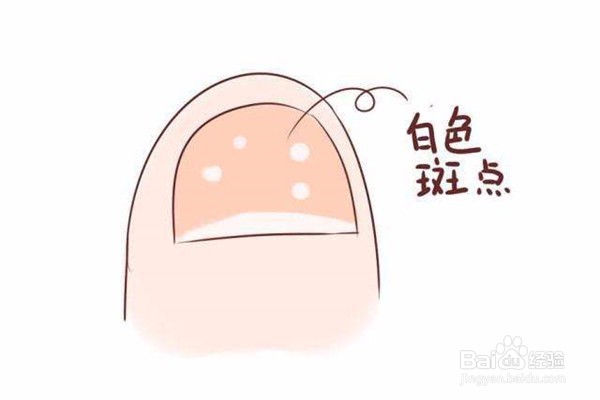 指甲上长白色的斑是怎么一回事?