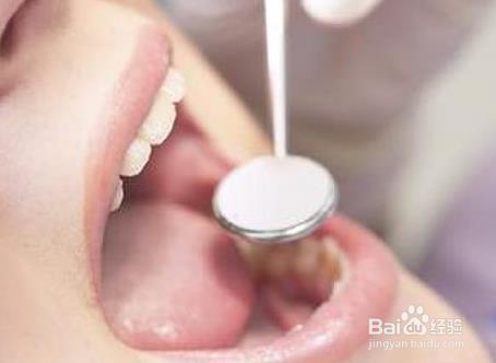 经常口腔溃疡是什么原因和治疗方法。