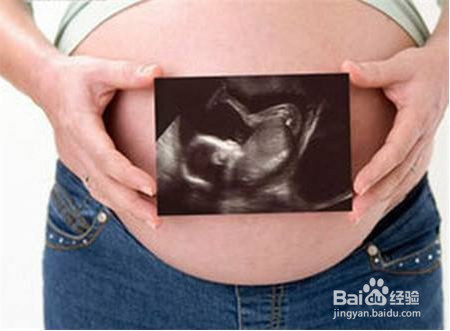 准妈妈腹痛如何判断是否需要上医院