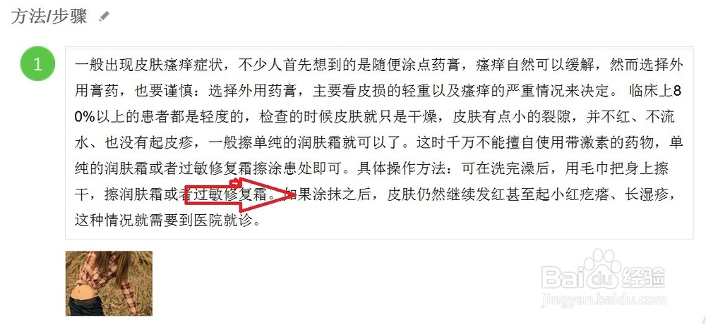 皮肤瘙痒用什么药膏