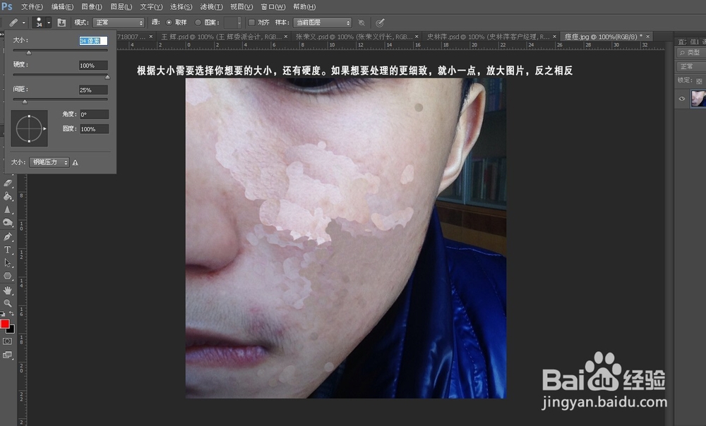 如何用PS去痘痘