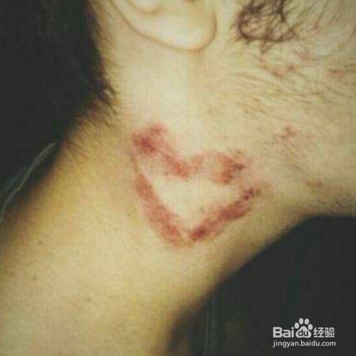 怎样用化妆做假吻痕 ?