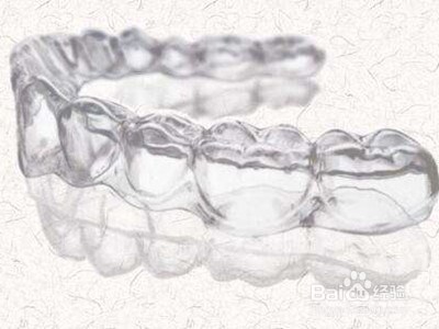 保持器分几种？