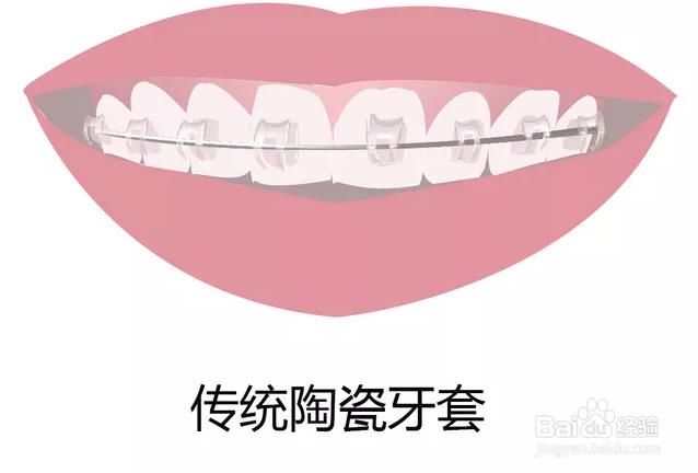 合肥种植牙哪家医院比较好-行业收费揭秘?