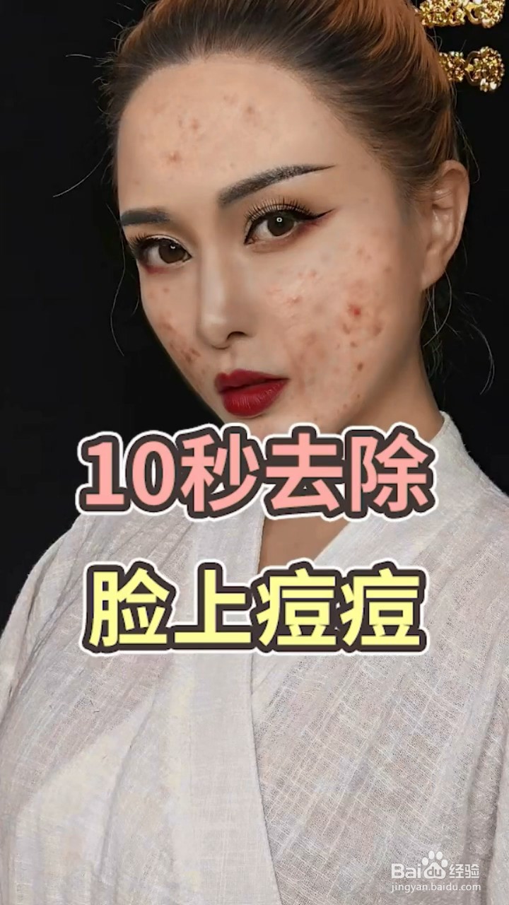 美女脸上长了许多小痘痘,想让我们帮她去除怎么办?