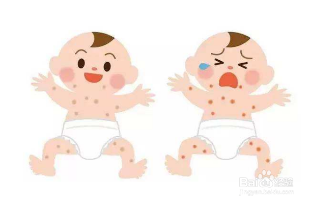 婴儿湿疹怎么办这些重点宝妈们一定要牢记