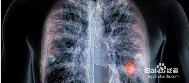 吸烟的七大危害