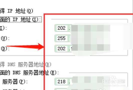 宽带ip地址怎么设置