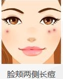 如何通过长痘痘的位置针对性的祛除痘痘