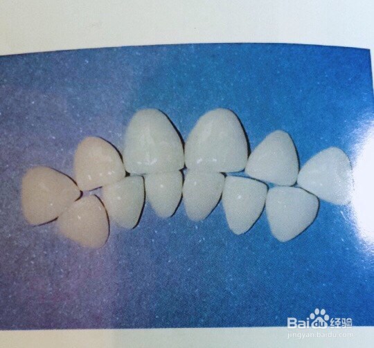 什么是全瓷冠修复