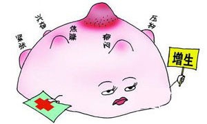 乳腺增生怎么办？乳腺增生的治疗方法