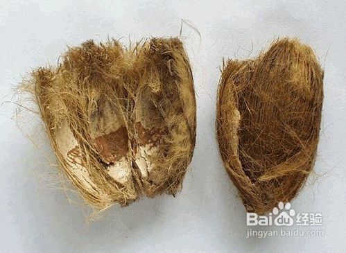 肾性水肿治疗4招