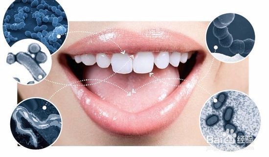 引起口臭的原因以及如何治疗口臭