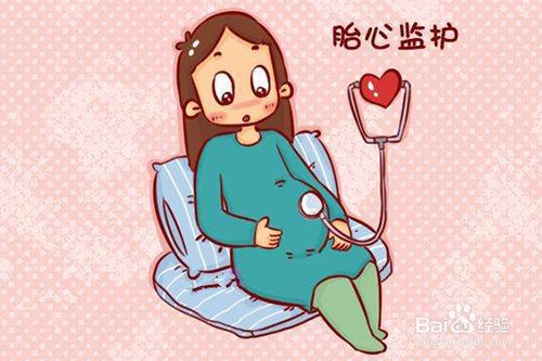 哪几次产检是必须要做的