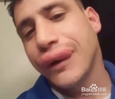 牙膏在生活中的妙用