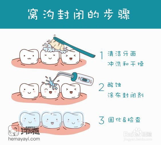 什么是窝沟封闭,为什么要做窝沟封闭?