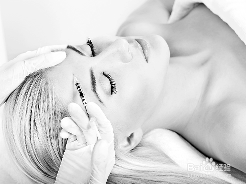 怎么去眉间皱纹