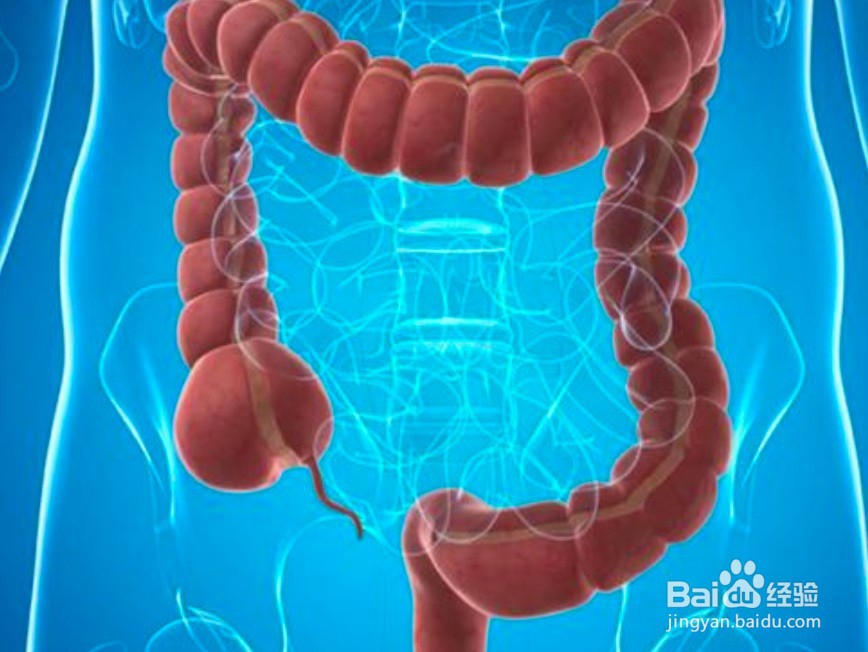 结肠癌术后饮食