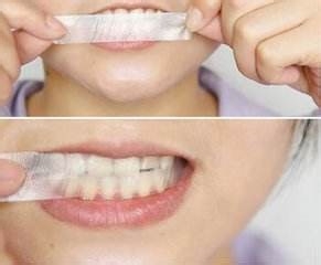 牙齿如何美白你对牙齿美白有哪些误区