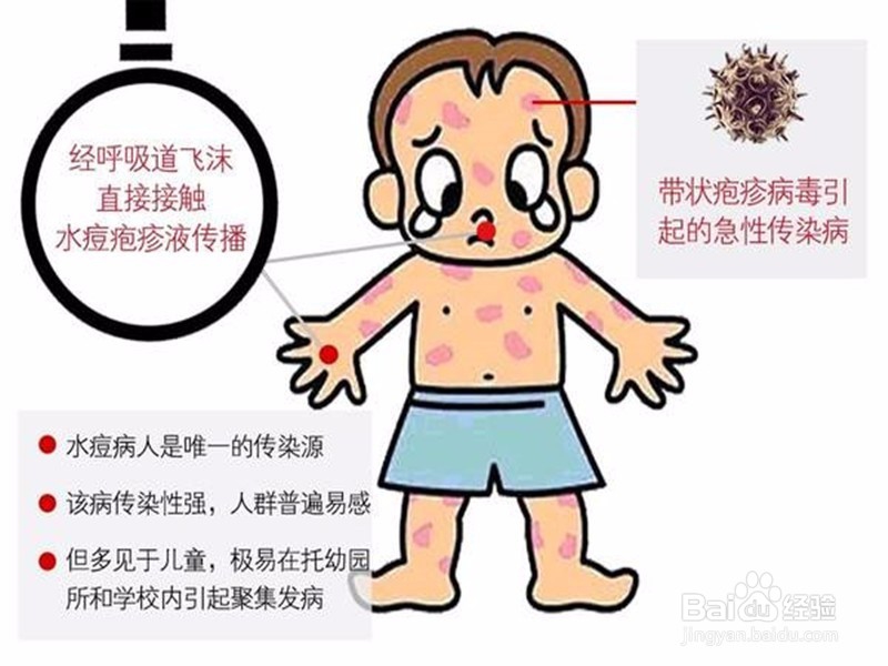 宝宝长了水痘怎么护理