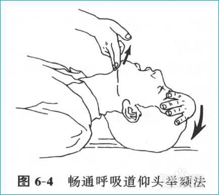 急救知识--心肺复苏