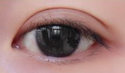 眼皮薄怎么贴双眼皮贴