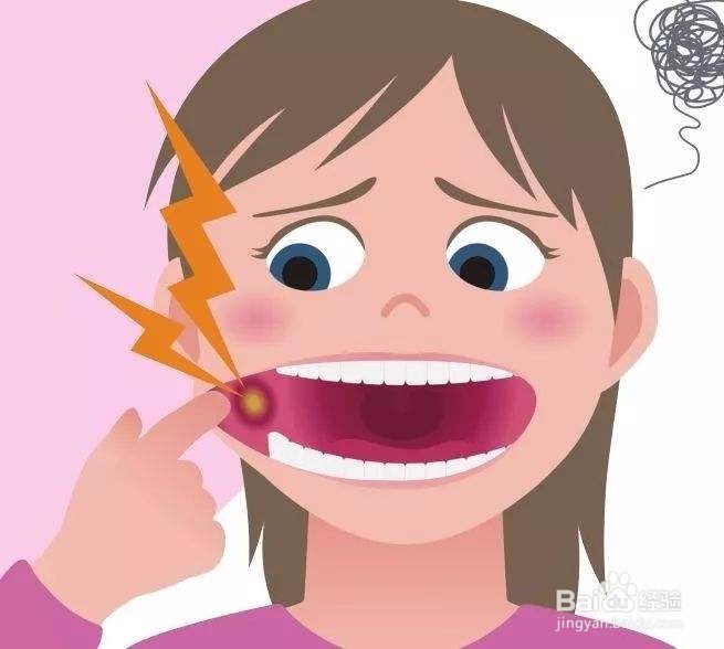 引起口腔溃疡的原因和解决办法
