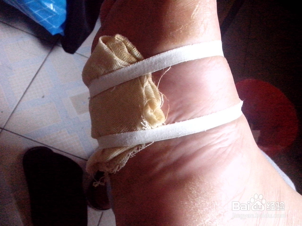 怎样自己给自己敷药