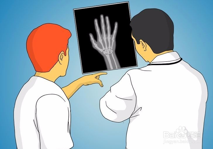 如何诊断拇指是否骨折?