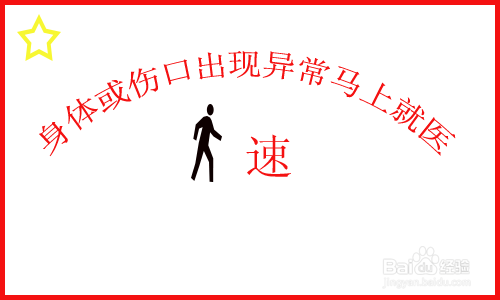 有蜱虫怎么办