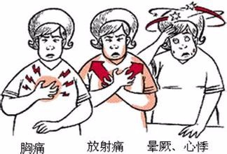 冠状动脉粥样硬化性心脏病的用药指导