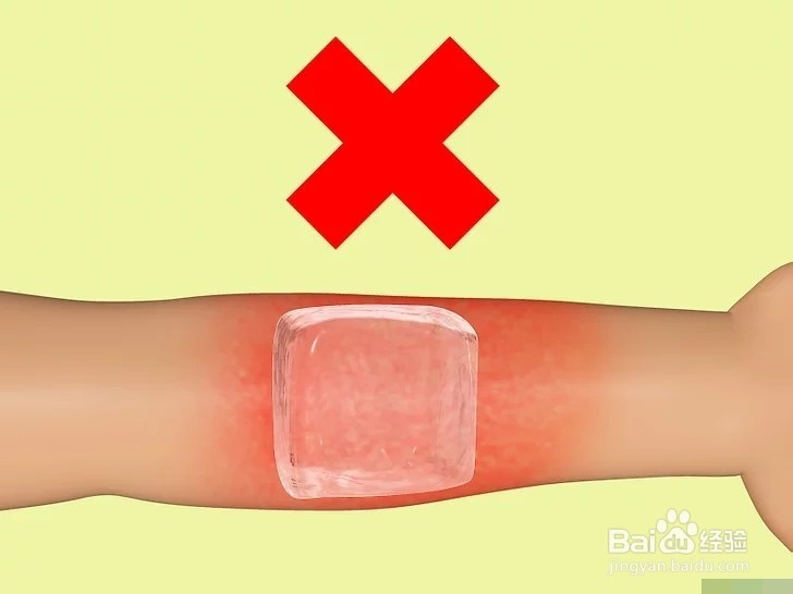 如何治疗烧伤？