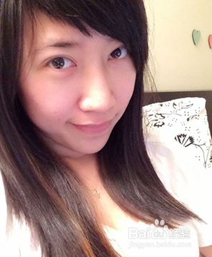 全切双眼皮效果很不错