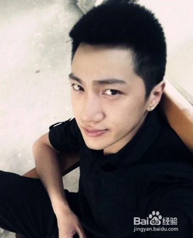 发际线低怎么办