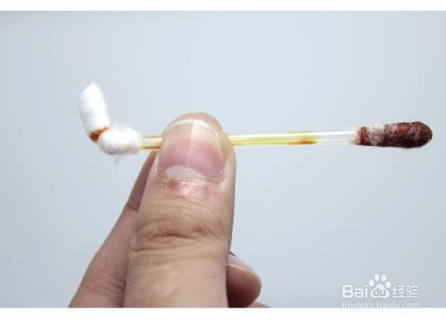 给猫剪指甲出血了怎么办