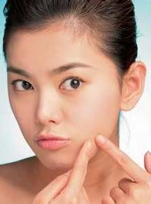 女性长痤疮的原因是什么呢