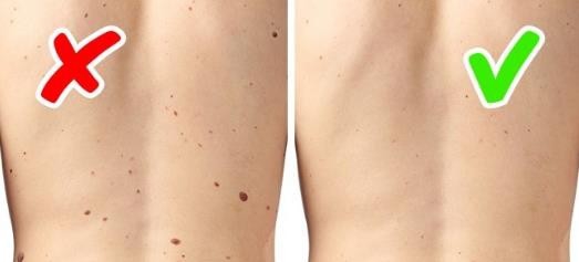 如何通过皮肤症状判断身体健康情况