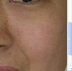 Photoshop CS2.0教你怎样祛痘和让图片亮