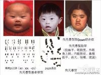 如何预防胎儿先天性畸形