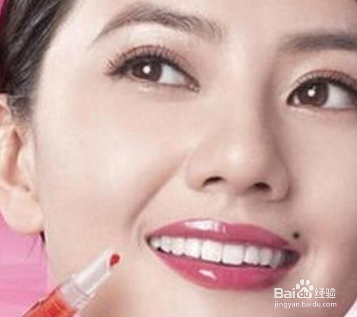 为什么痦子不能随便去掉？有什么危险？