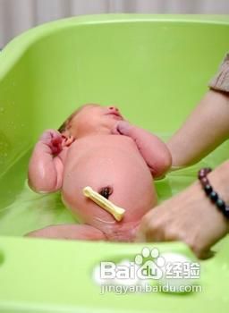 新生儿的脐带应该怎么护理呢