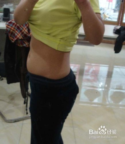 纹丝不长之妊娠纹歼灭战