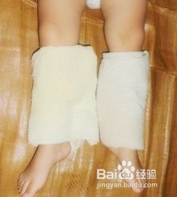 湿毛巾退烧的正确方法