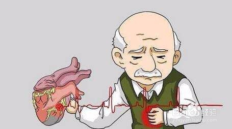 冠心病人如何睡眠