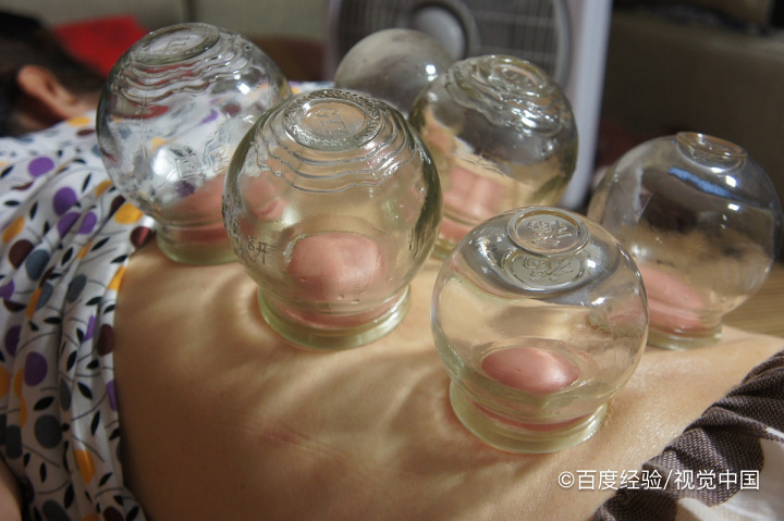 拔罐的手法操作教程